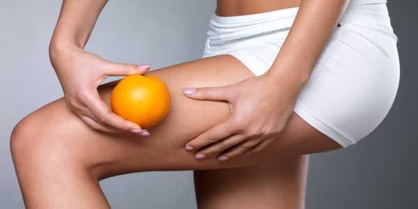 Celulitis: Qué es y cómo combatirla